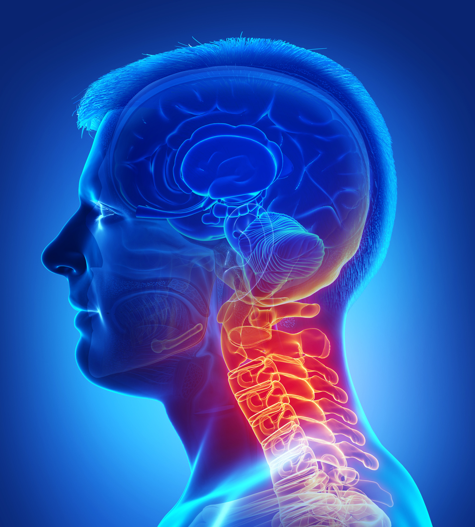 Neck & Arm Pain - Neurosurgery of St. Louis