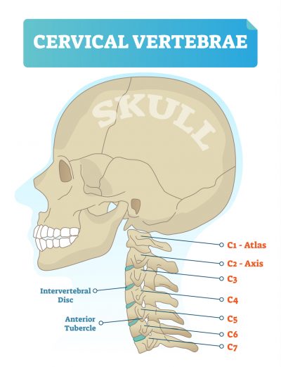 cervical-vertebrea-st-louis-neurosurgeons