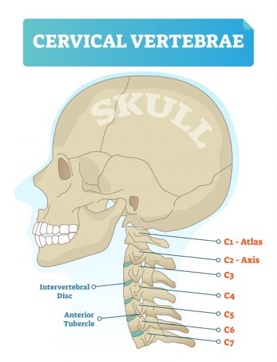 cervical-vertebrea-st-louis-neurosurgeons